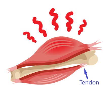 Muscle Injuries edited Muscle Injuries edited