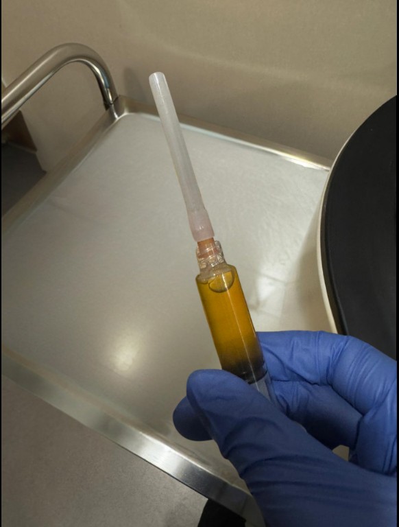 PRP for Knees 3