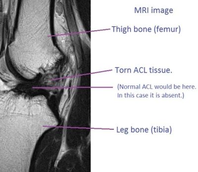 Alam-Khwrshed-MRI2e.jpeg